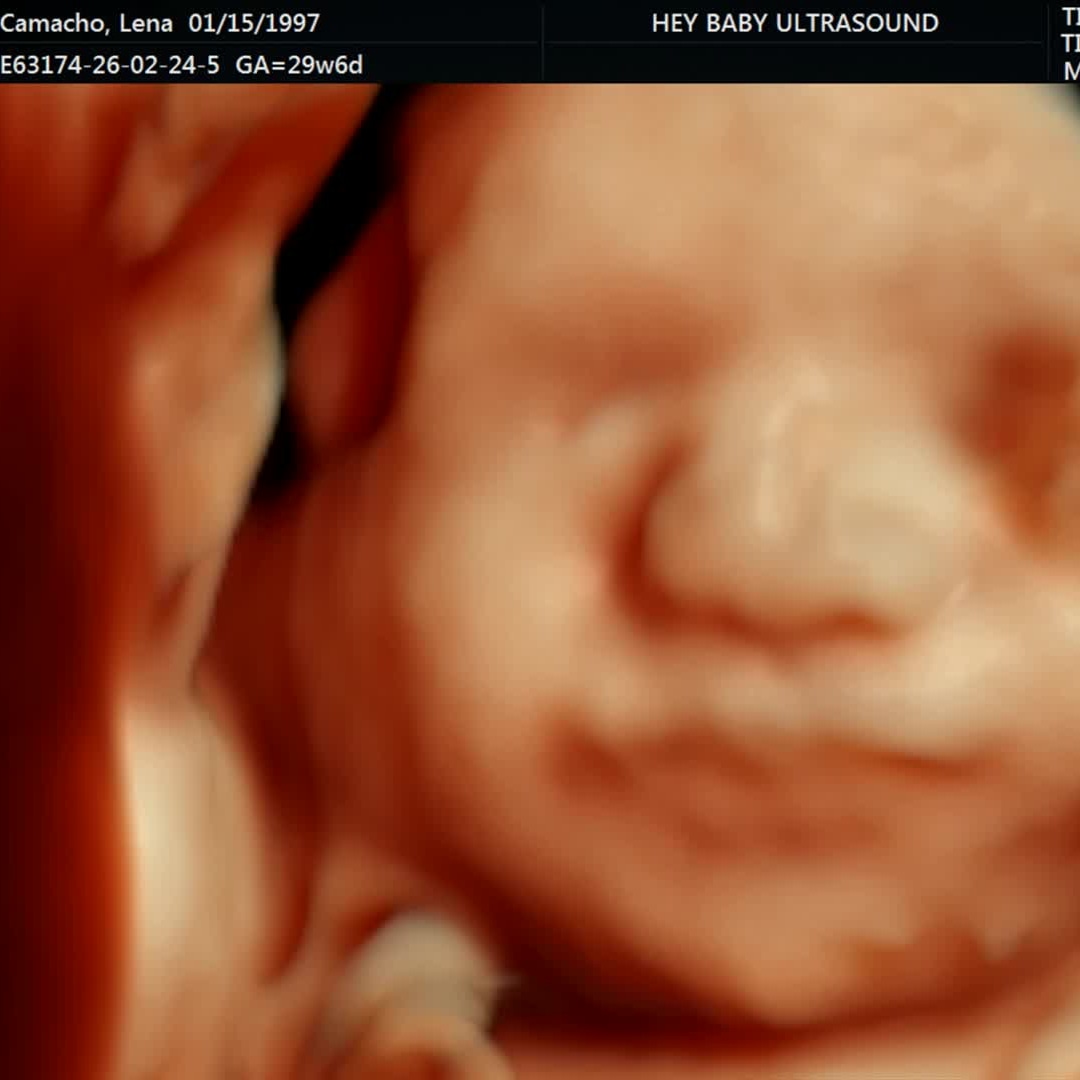 Photo shared by Lena for their Babylist baby registry.