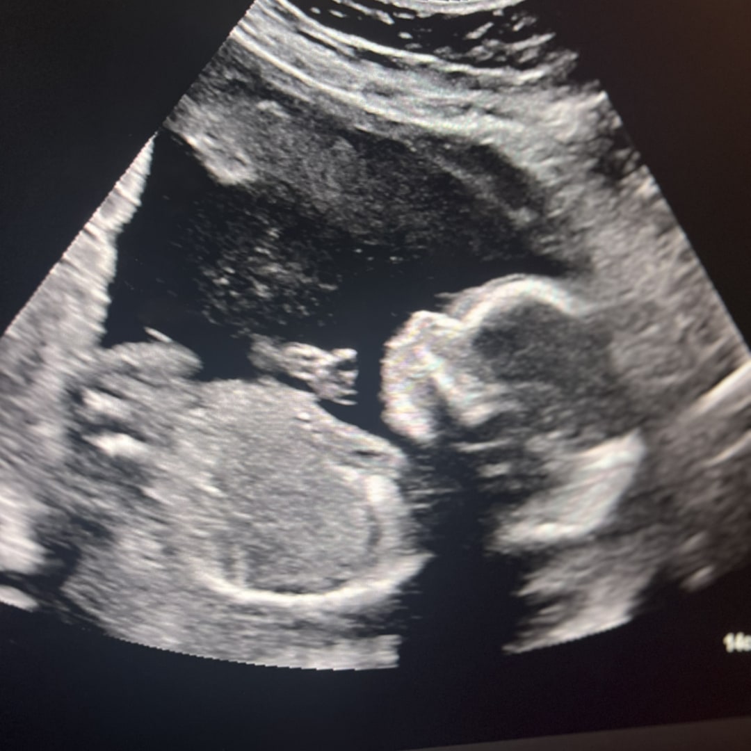 Photo shared by Alexandra for their Babylist baby registry.