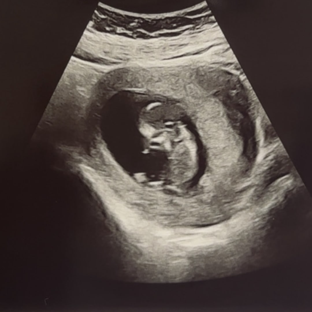Photo shared by Desima for their Babylist baby registry.