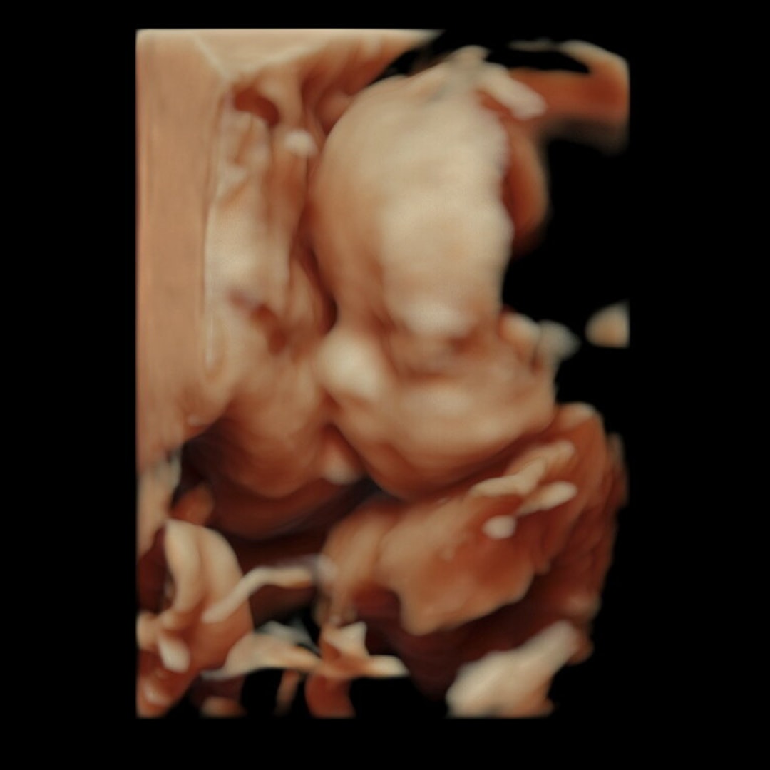 Photo shared by Berlin for their Babylist baby registry.