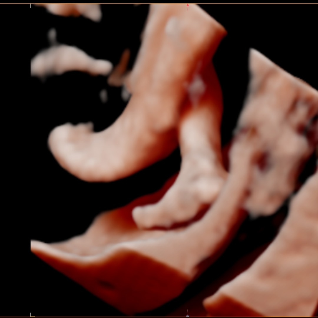 Photo shared by Adilya for their Babylist baby registry.