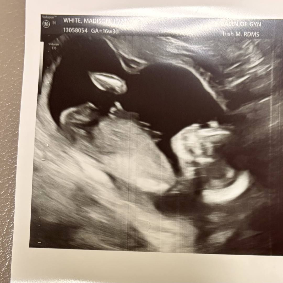Photo shared by Madison for their Babylist baby registry.