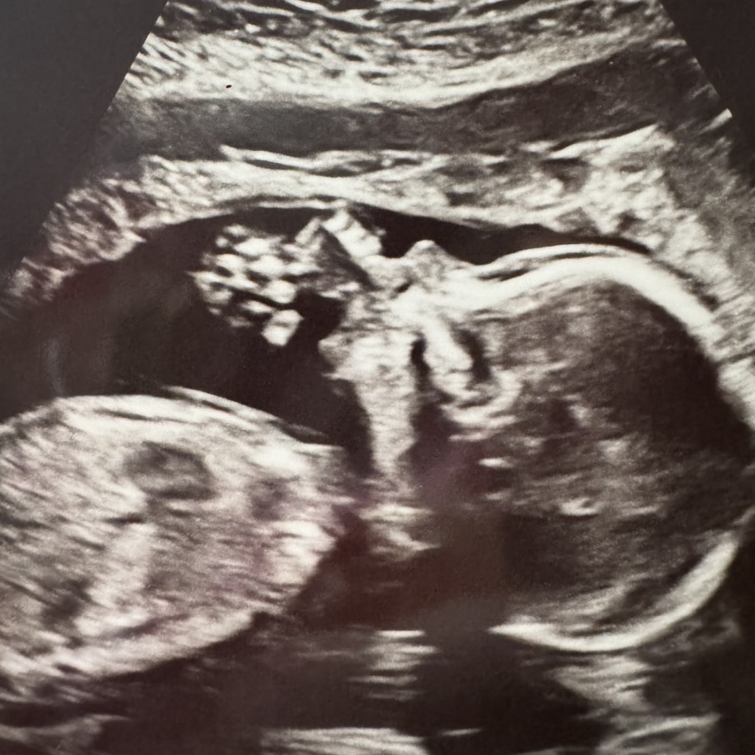 Photo shared by Emily for their Babylist baby registry.