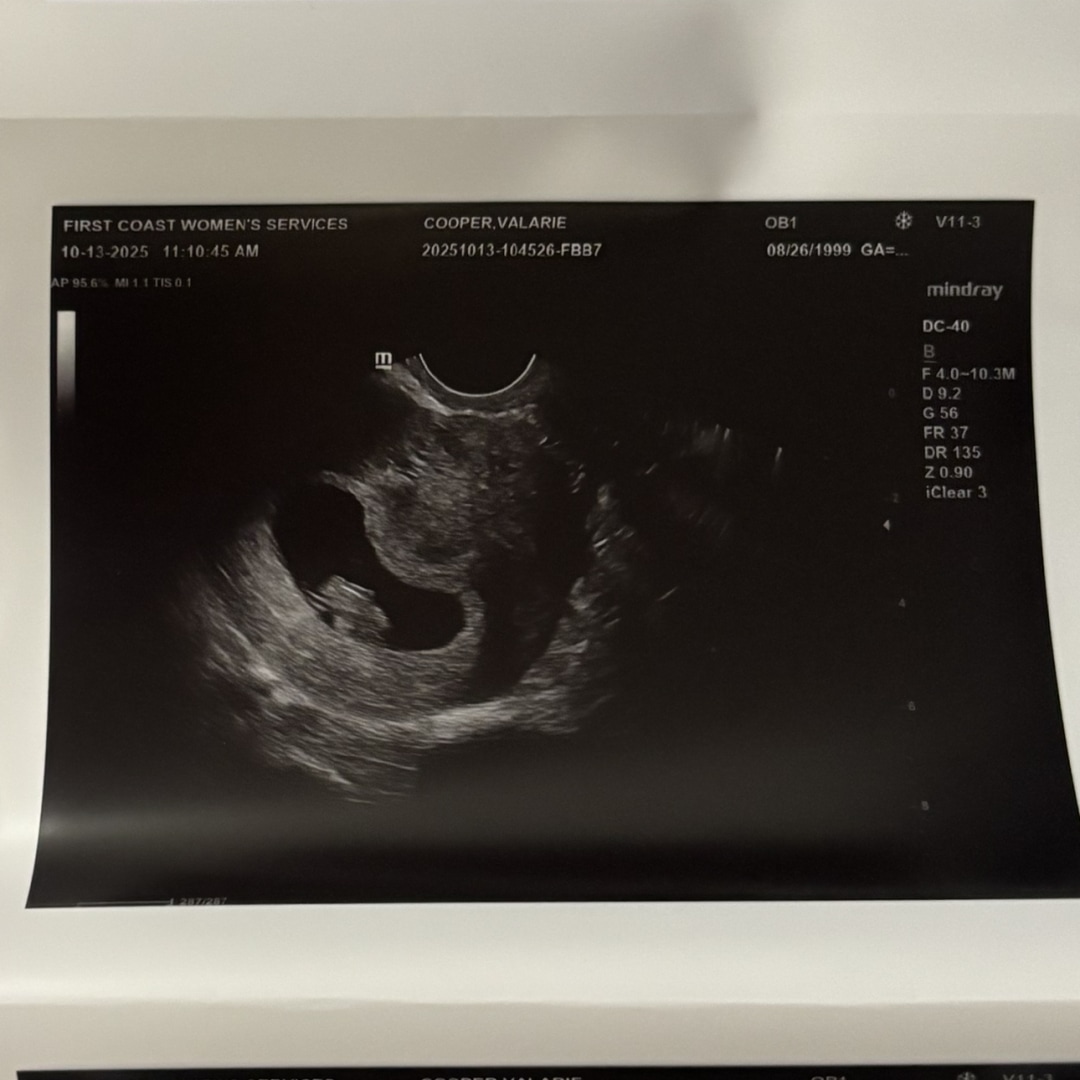 Photo shared by Valarie for their Babylist baby registry.