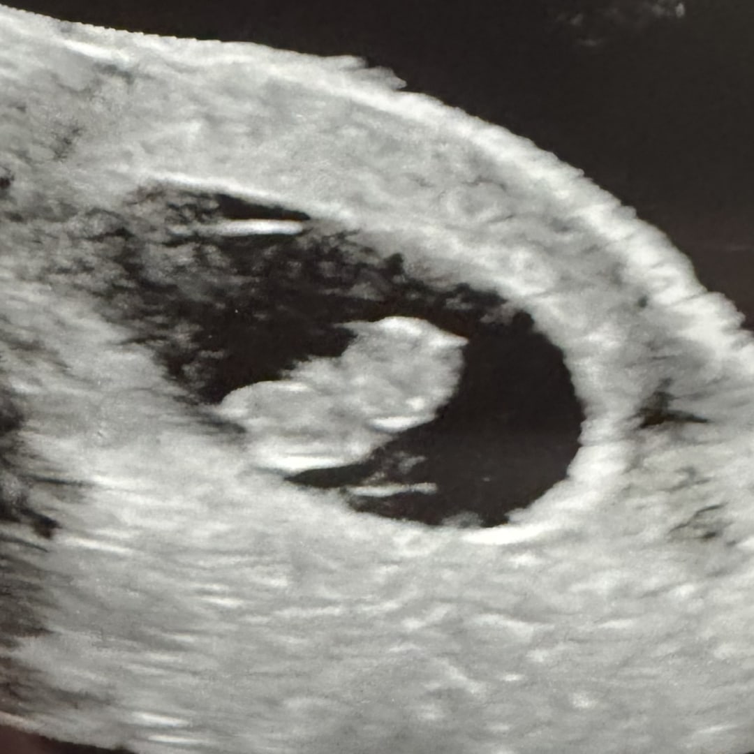 Photo shared by Sheila for their Babylist baby registry.