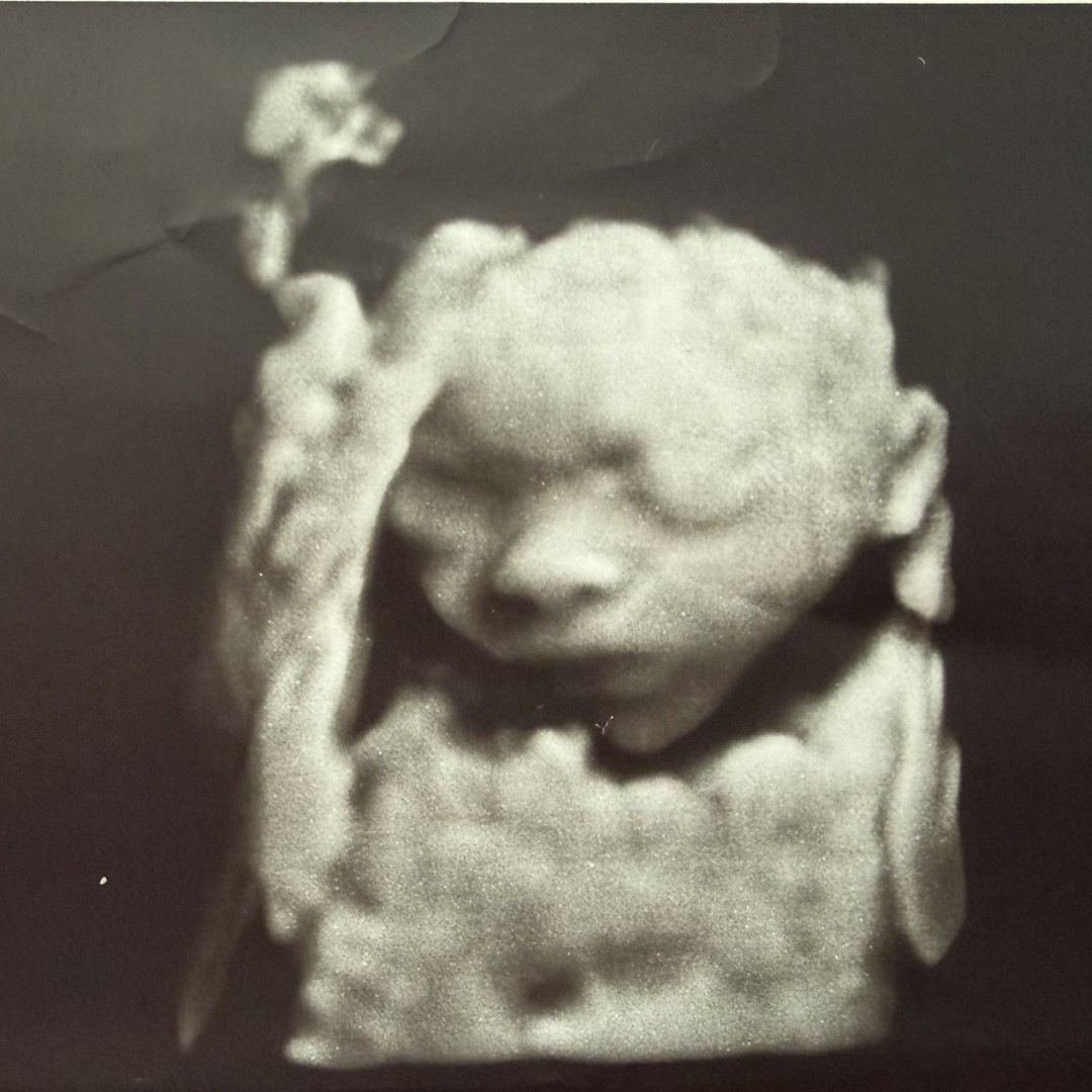 Photo shared by Azolea (Azzie) & Miguel for their Babylist baby registry.