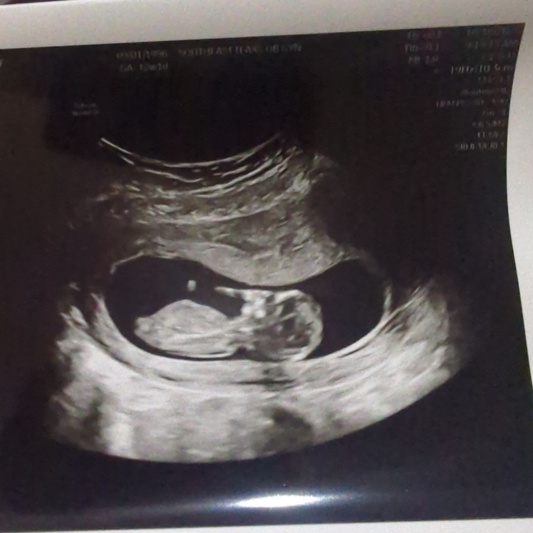 Photo shared by Destiny for their Babylist baby registry.