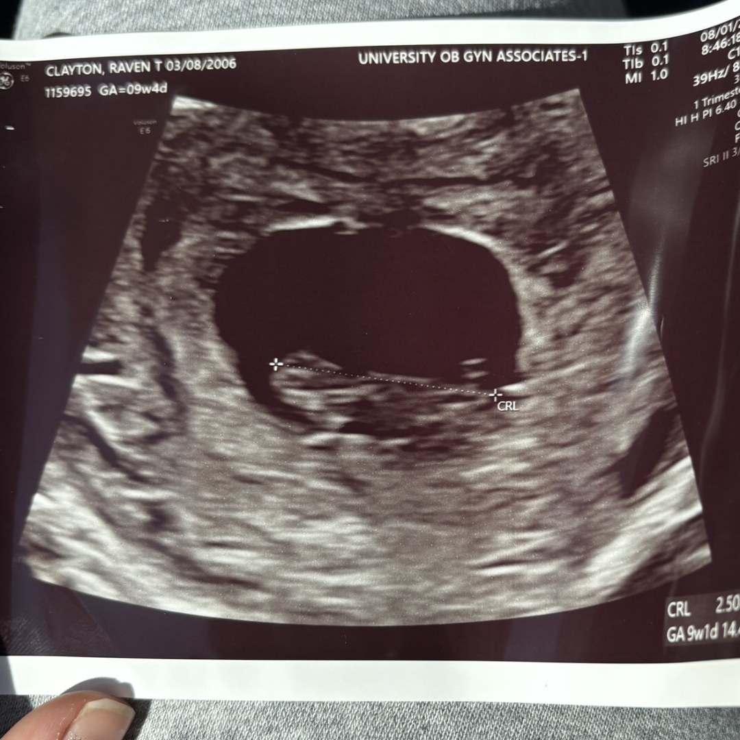 Photo shared by Raven for their Babylist baby registry.