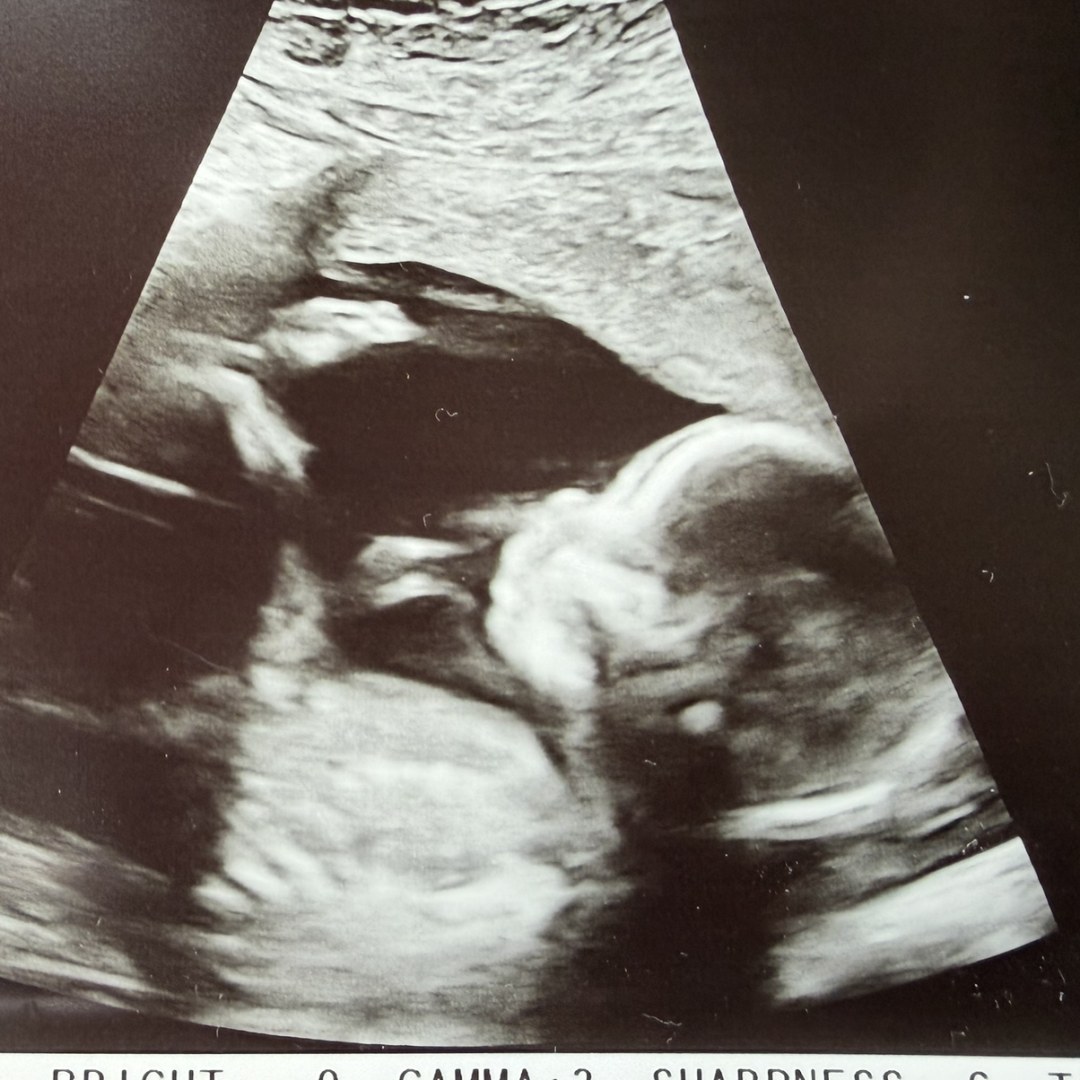Photo shared by Amanda for their Babylist baby registry.