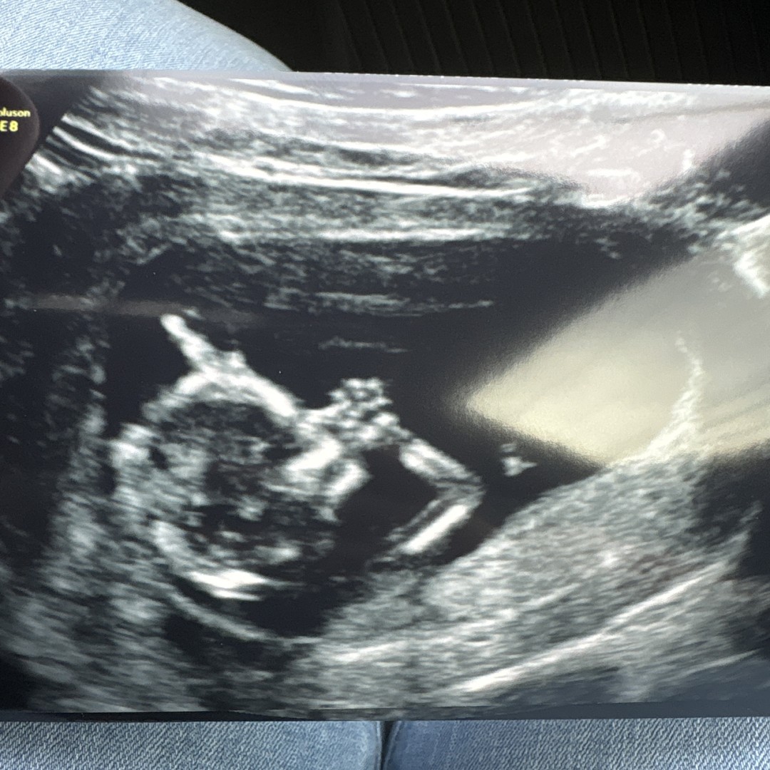 Photo shared by Antigone for their Babylist baby registry.