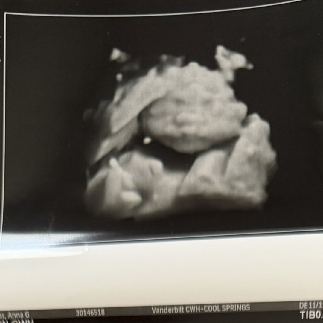 Photo shared by Anna for their Babylist baby registry.