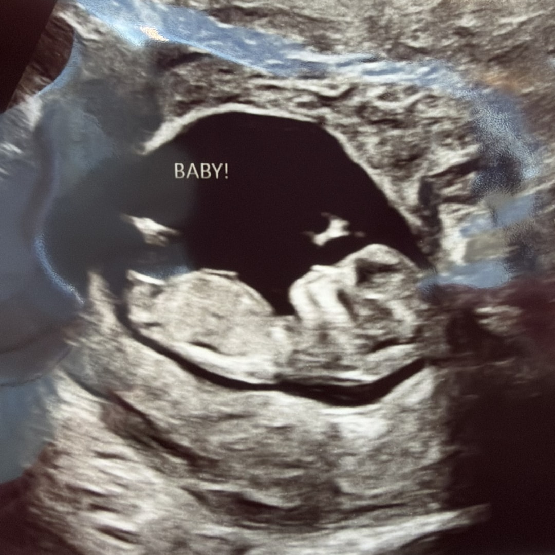 Photo shared by Naomy for their Babylist baby registry.
