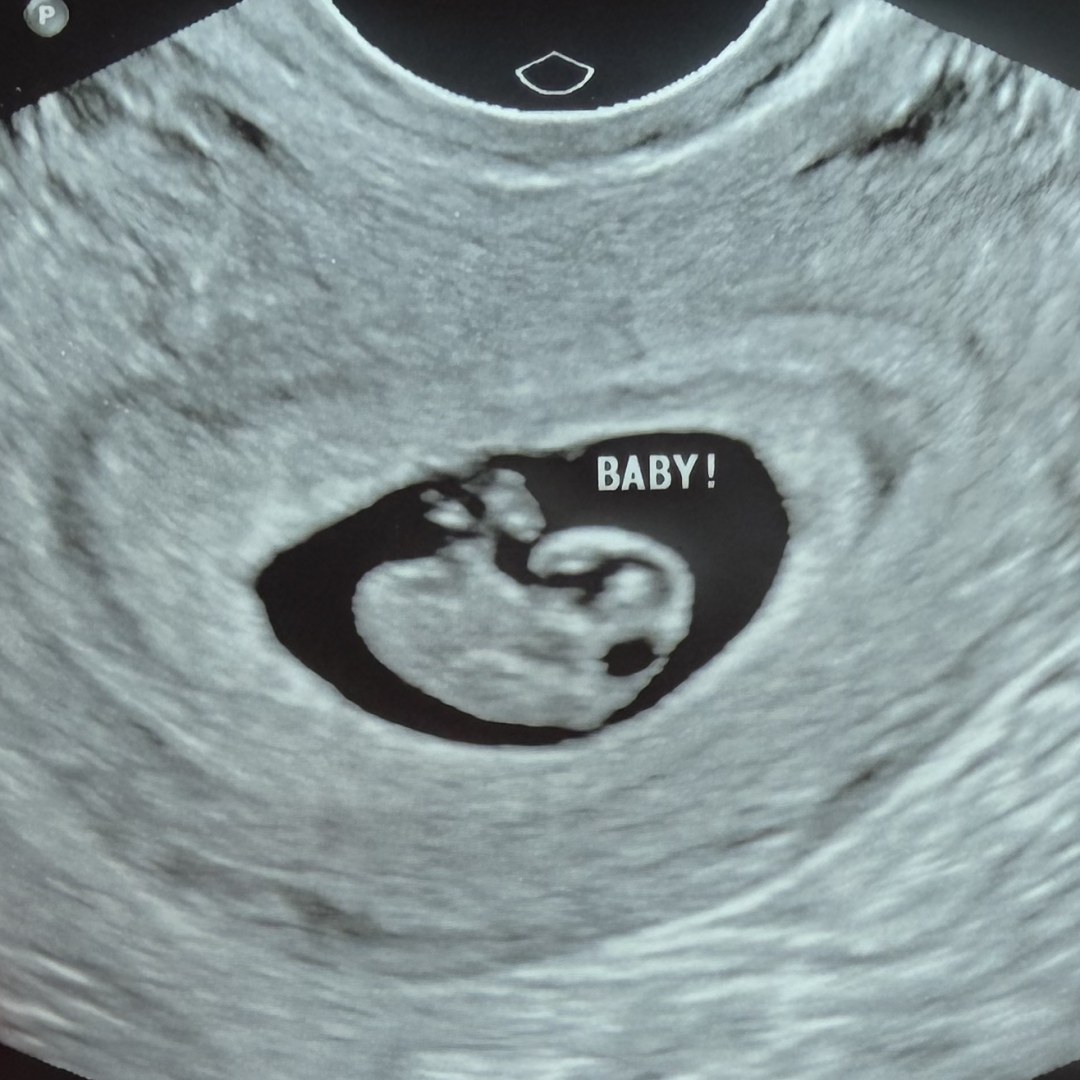 Photo shared by Rebekah for their Babylist baby registry.