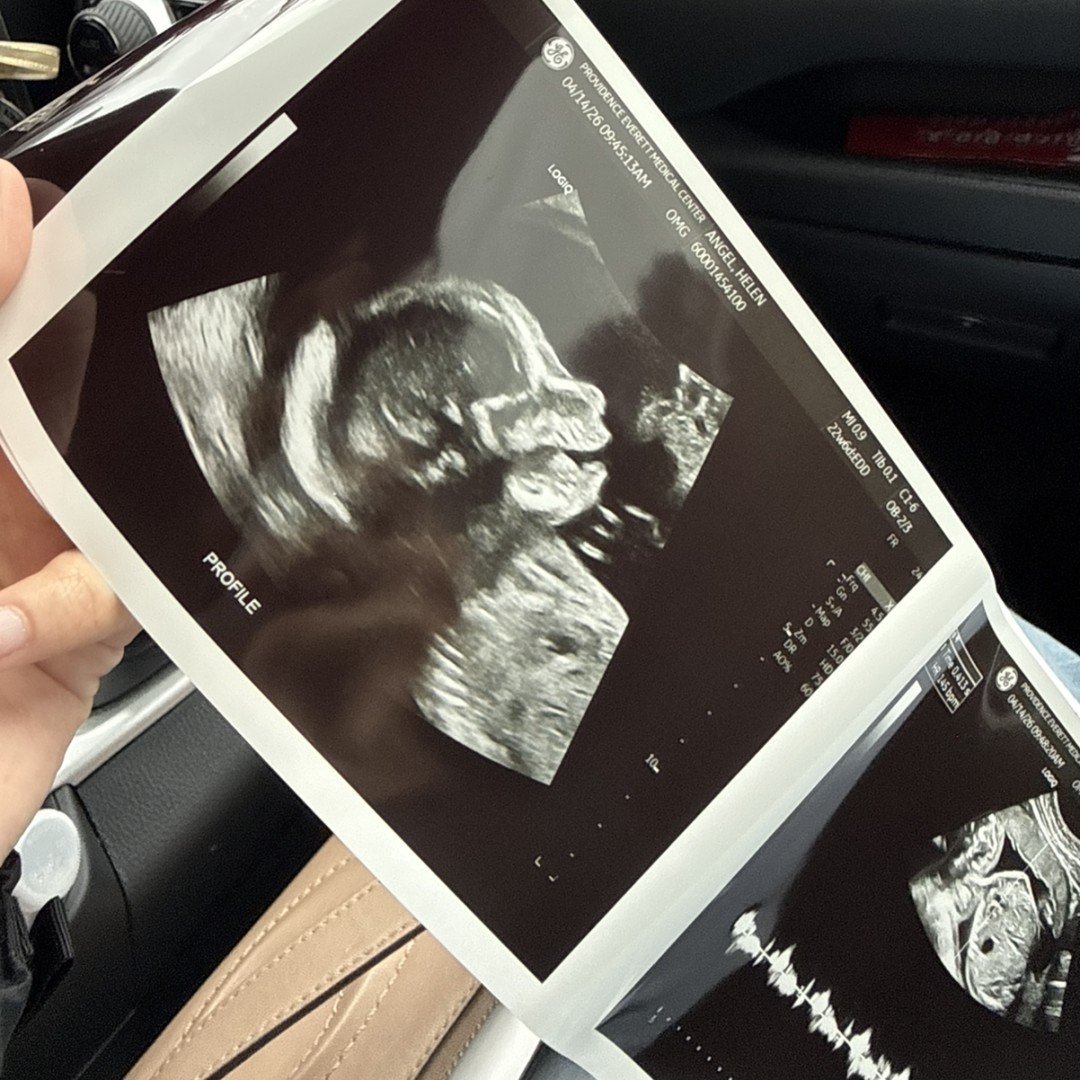Photo shared by Helen for their Babylist baby registry.