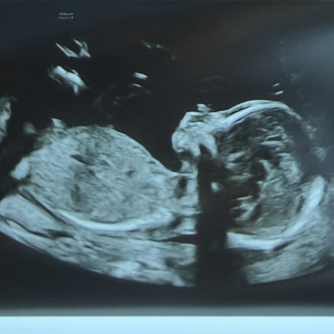 Photo shared by Melissa for their Babylist baby registry.