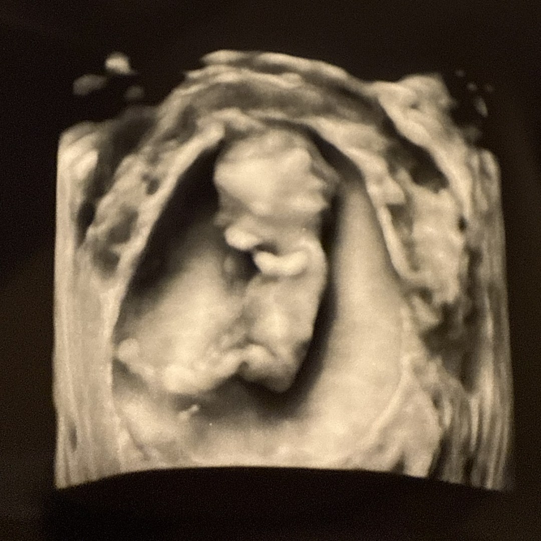 Photo shared by Hannah for their Babylist baby registry.