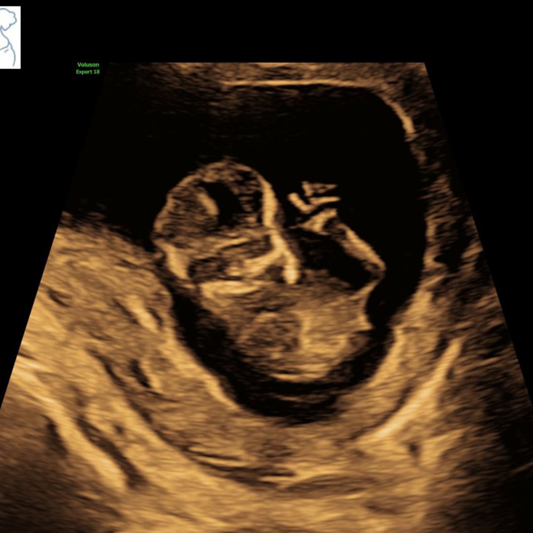 Photo shared by JANEXY for their Babylist baby registry.