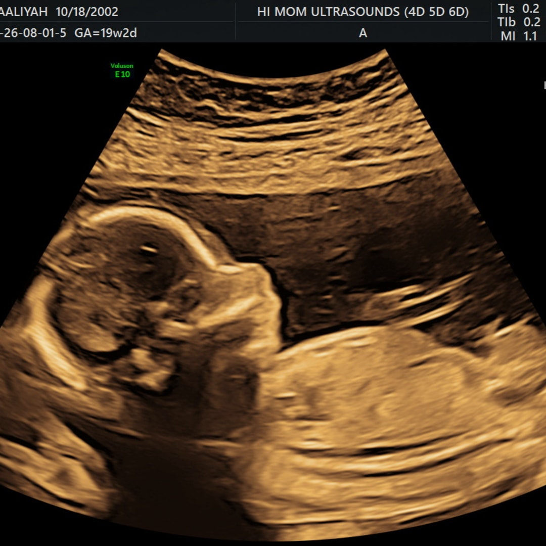 Photo shared by Aaliyah for their Babylist baby registry.