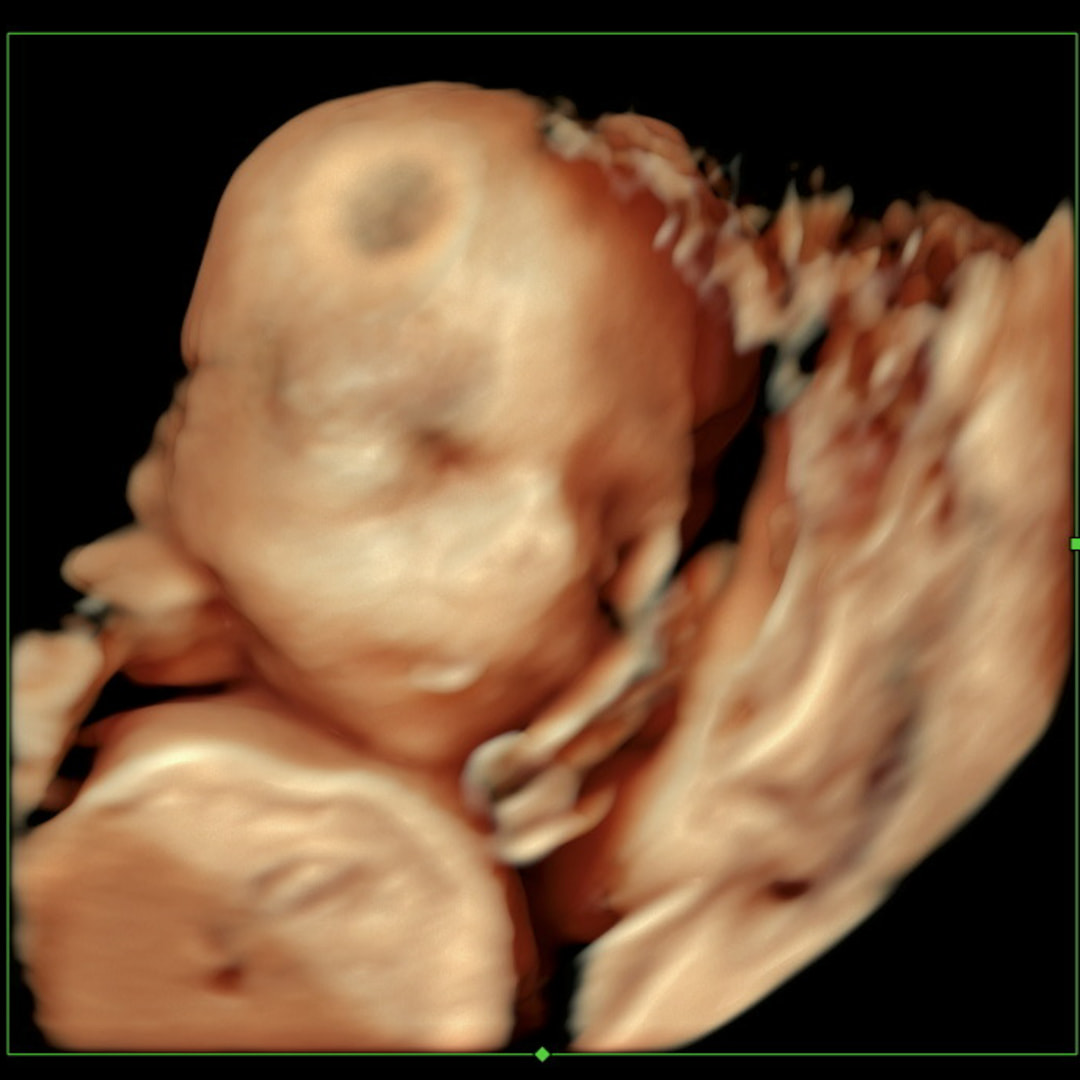 Photo shared by Teagan for their Babylist baby registry.