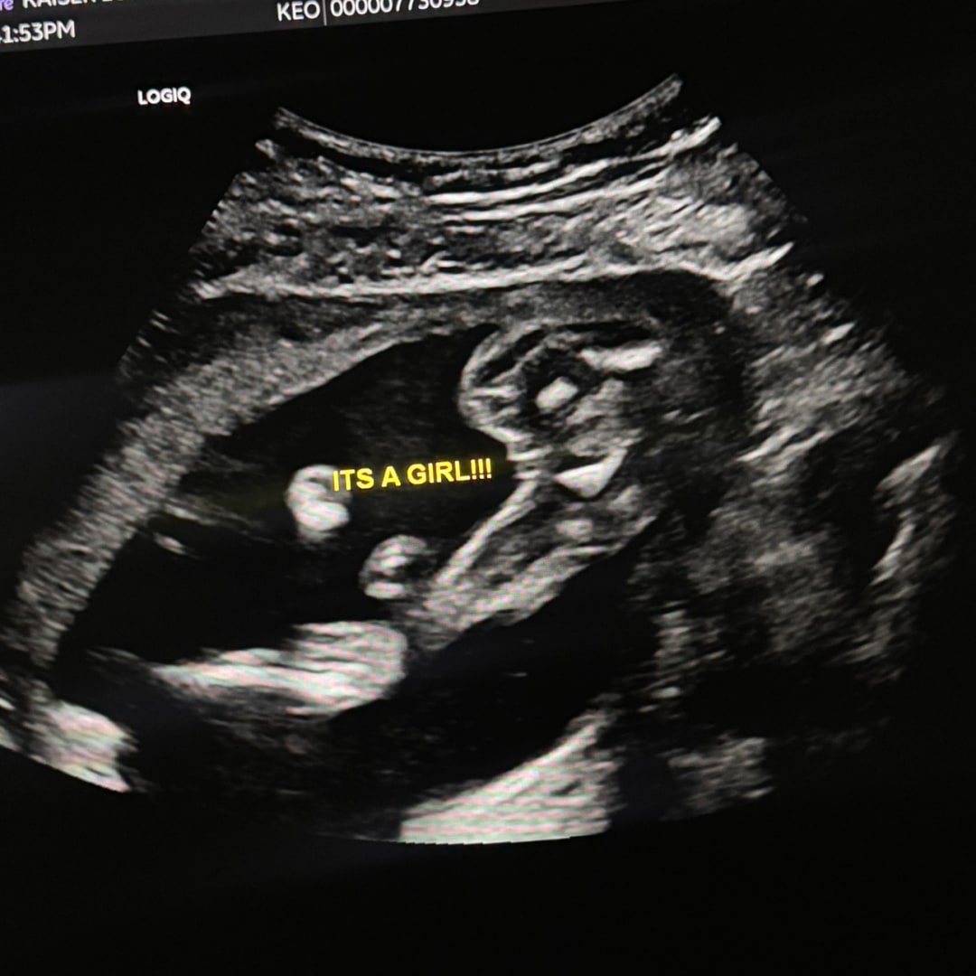 Photo shared by Camille for their Babylist baby registry.