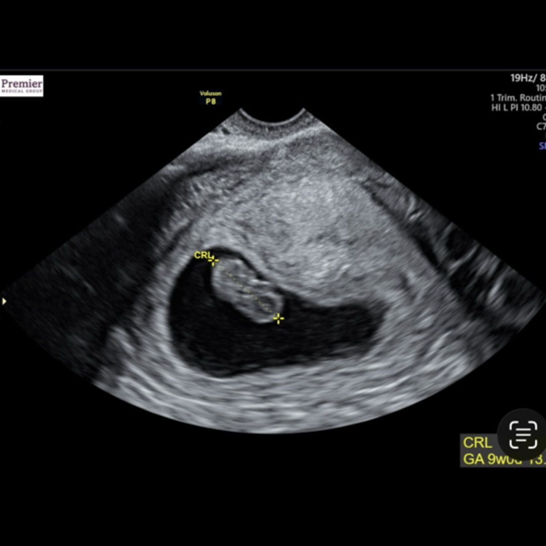 Photo shared by Alexis for their Babylist baby registry.