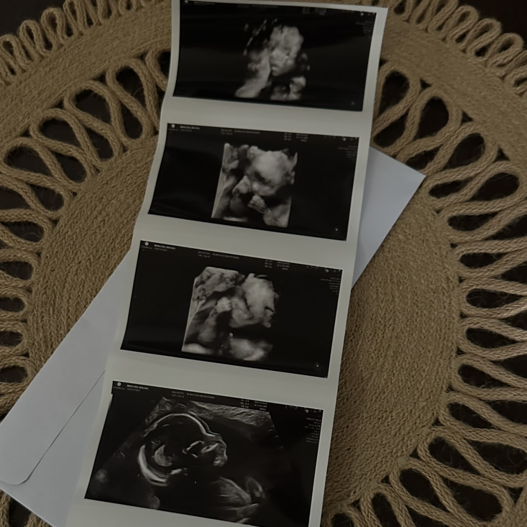 Photo shared by Rachel for their Babylist baby registry.