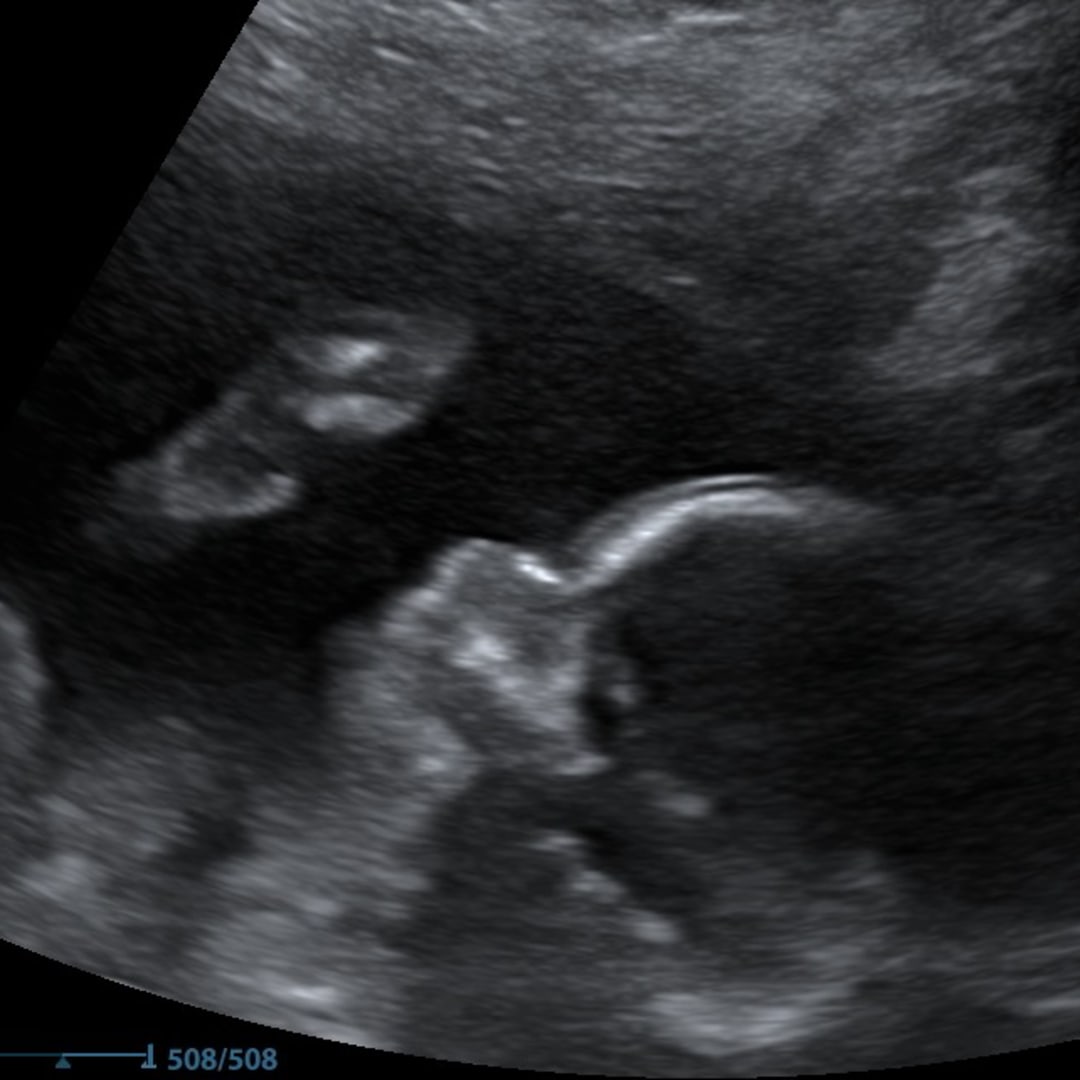 Photo shared by Cloe for their Babylist baby registry.