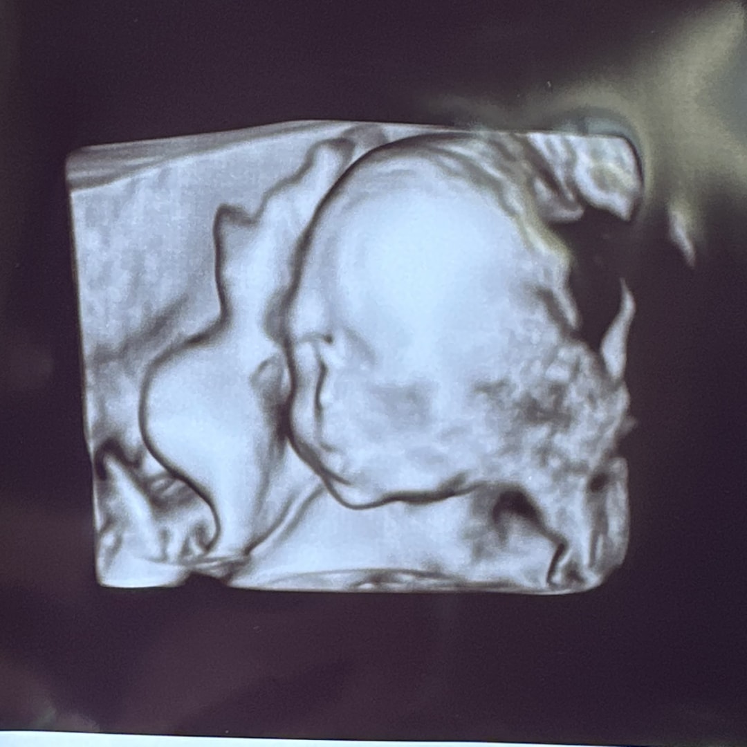 Photo shared by Megan for their Babylist baby registry.