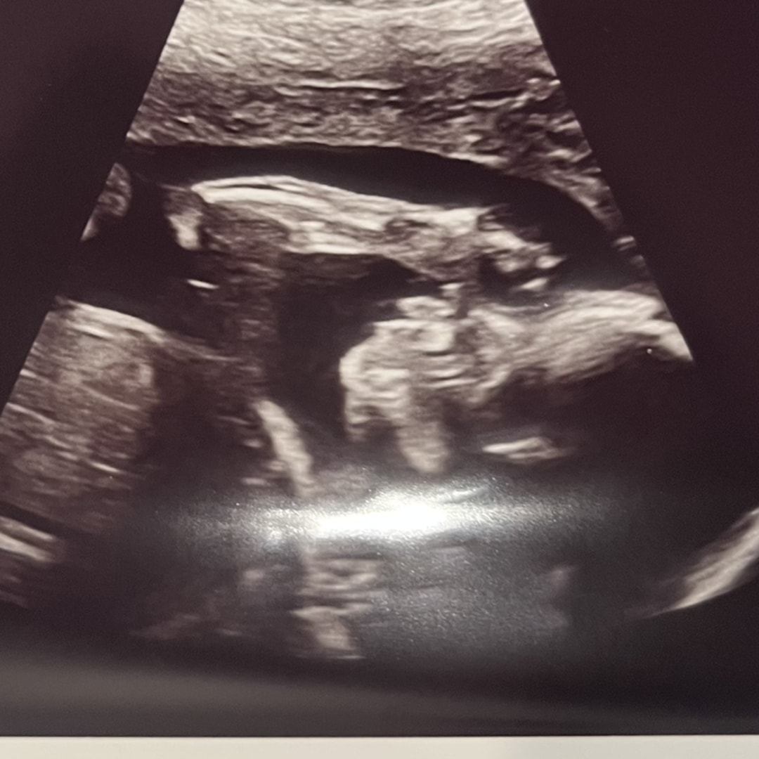 Photo shared by Carissa for their Babylist baby registry.