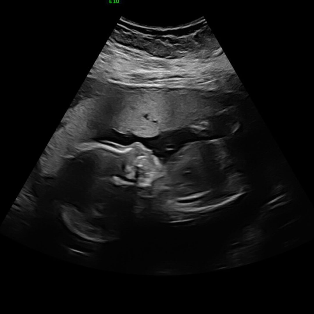 Photo shared by Jasmine for their Babylist baby registry.