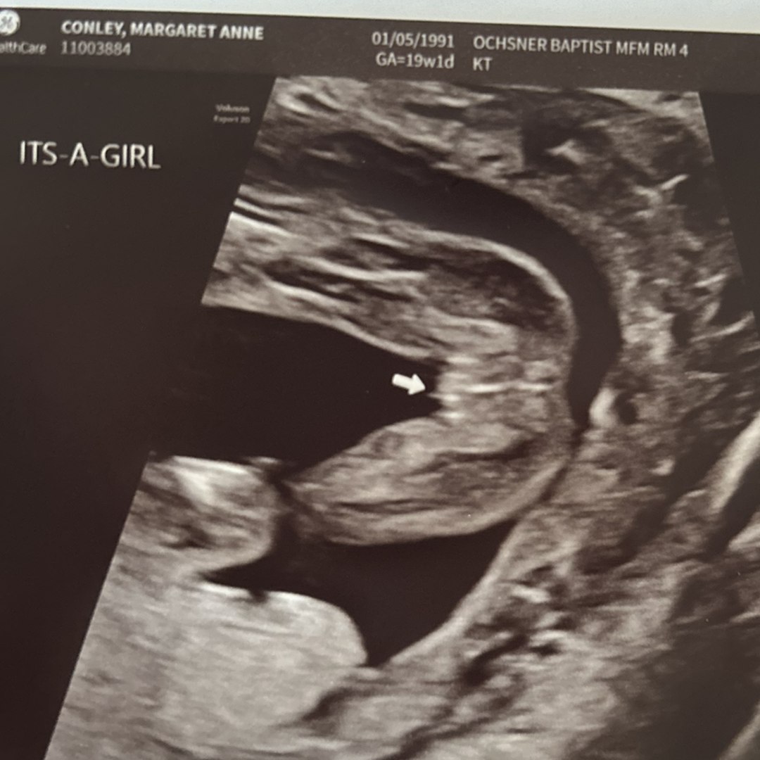 Photo shared by Maggie for their Babylist baby registry.
