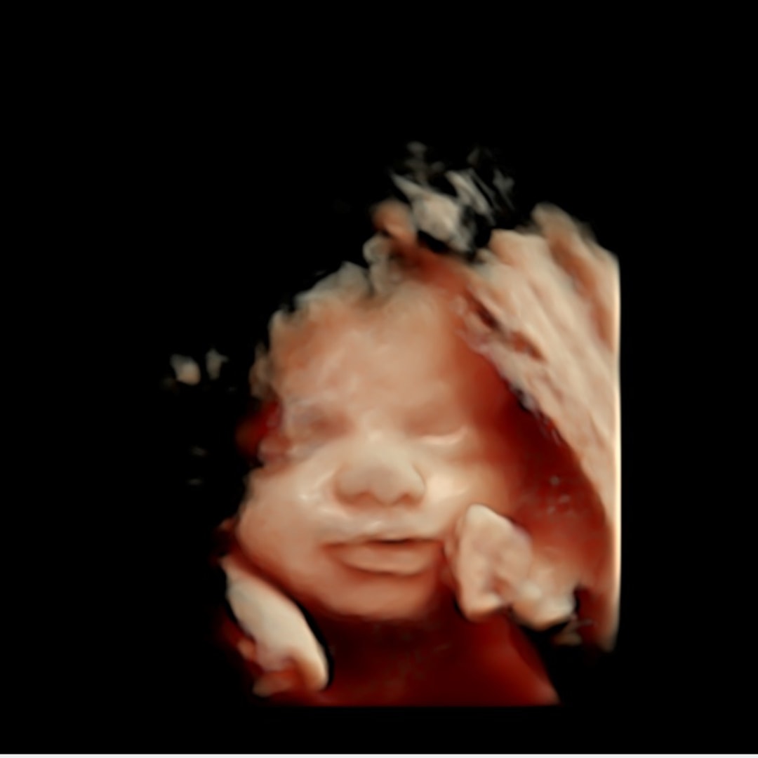 Photo shared by McKenna for their Babylist baby registry.
