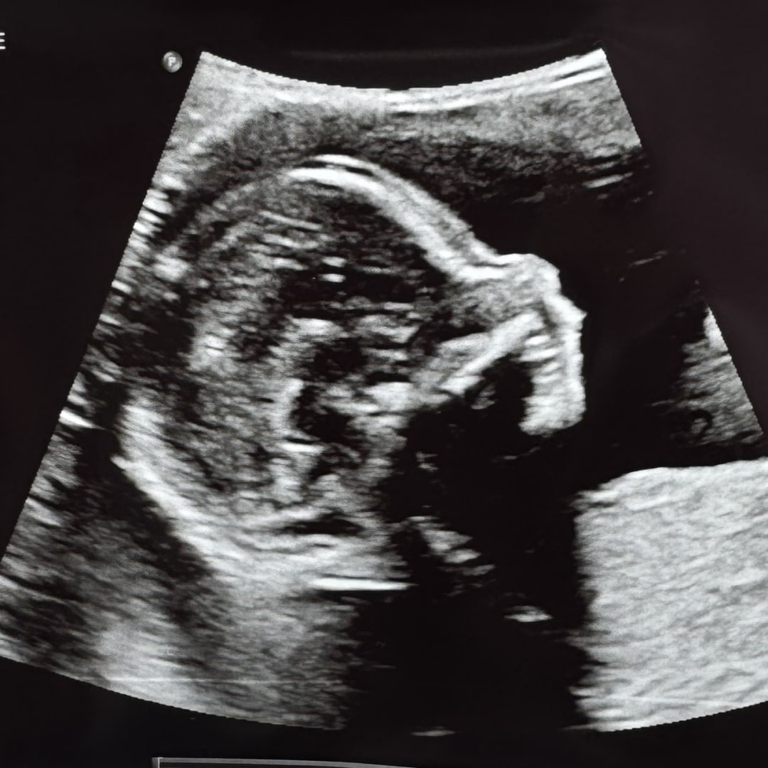 Photo shared by Ali for their Babylist baby registry.