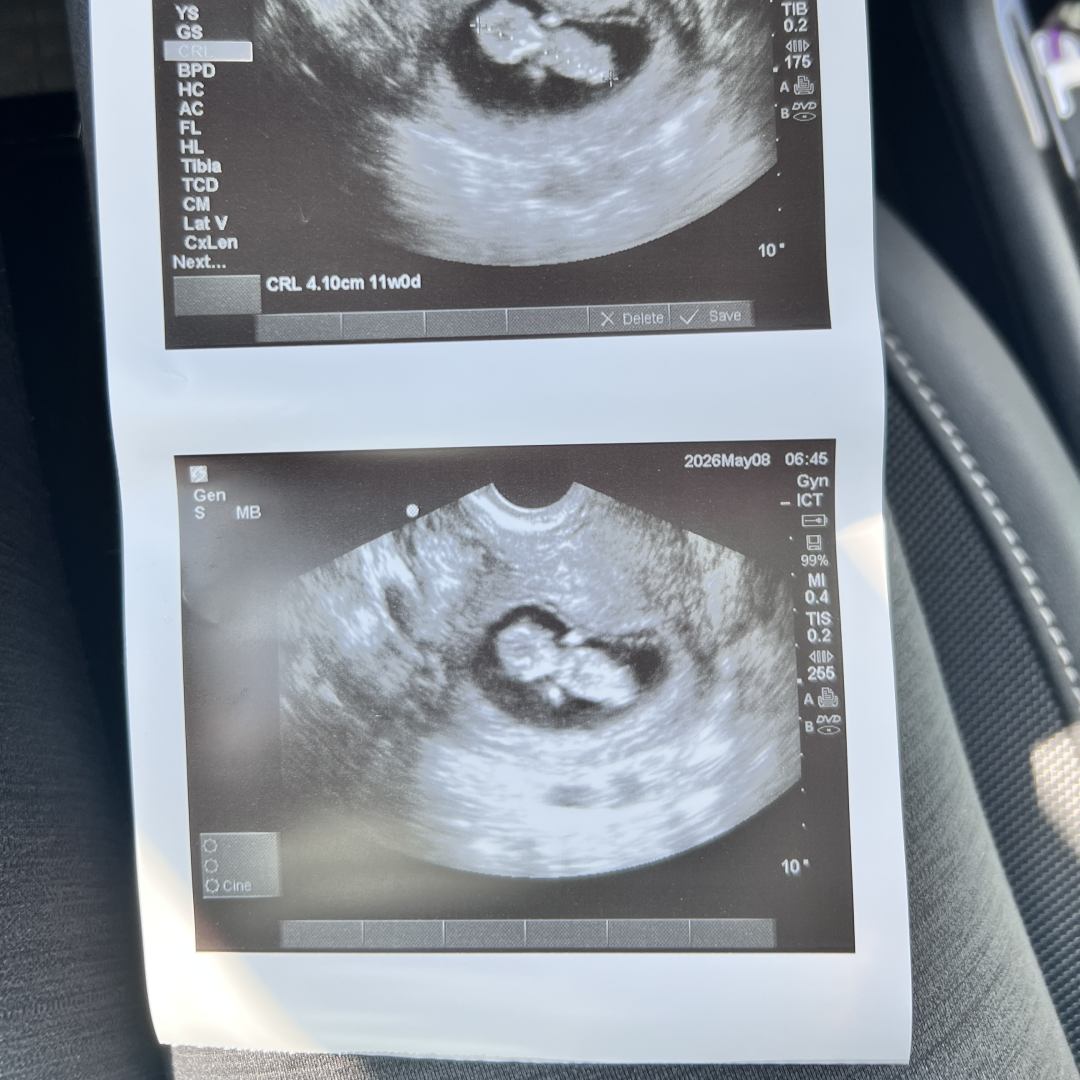 Photo shared by Ashley for their Babylist baby registry.