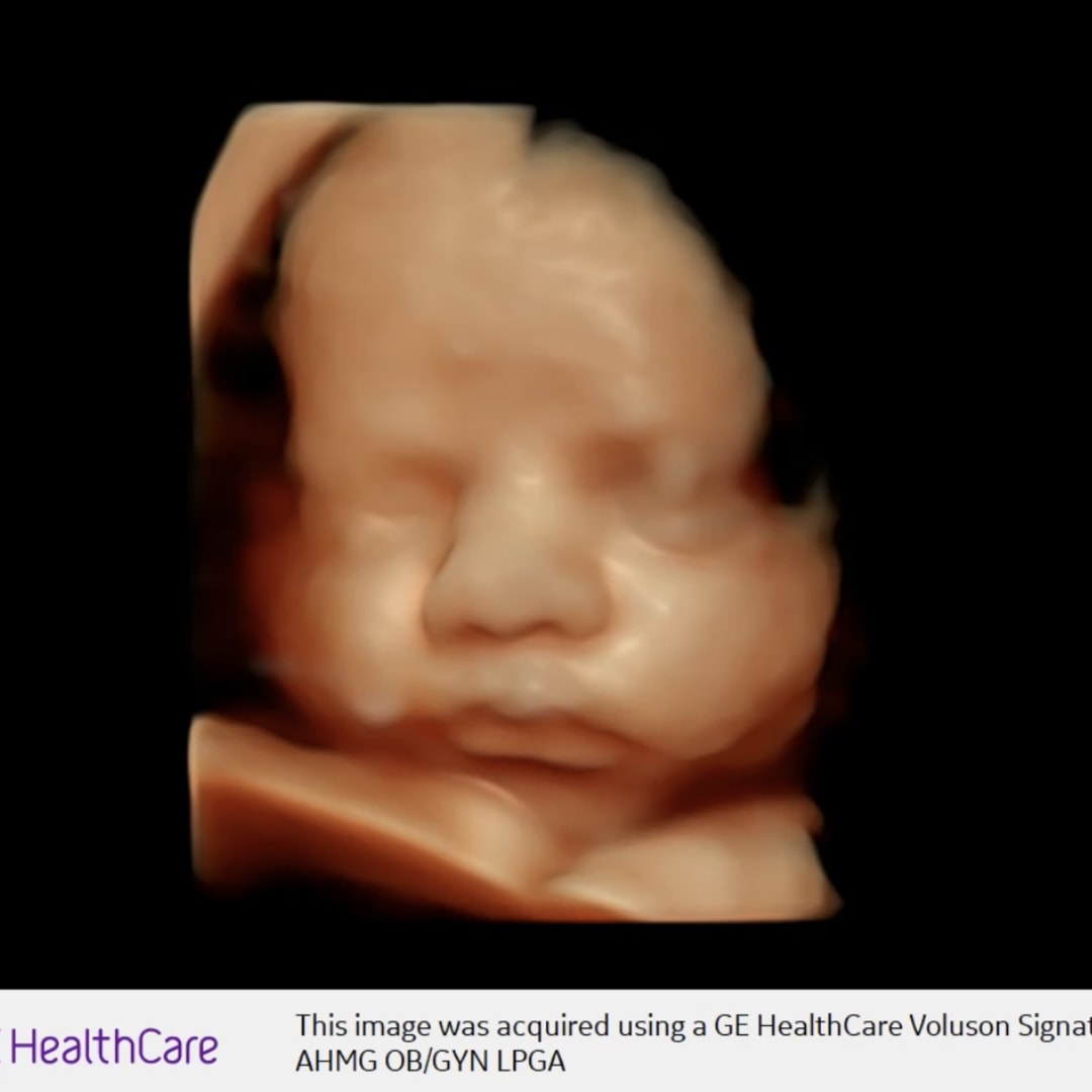 Photo shared by Alexis for their Babylist baby registry.