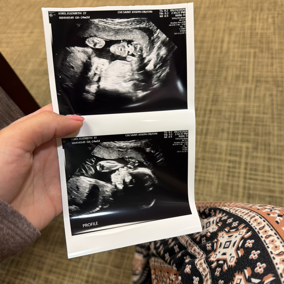 Photo shared by Elizabeth for their Babylist baby registry.