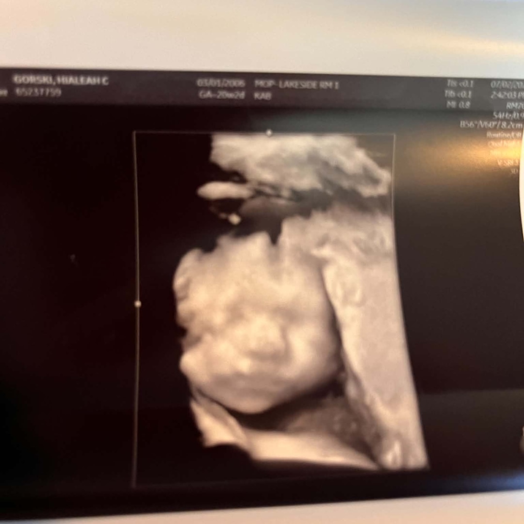 Photo shared by Hialeah for their Babylist baby registry.