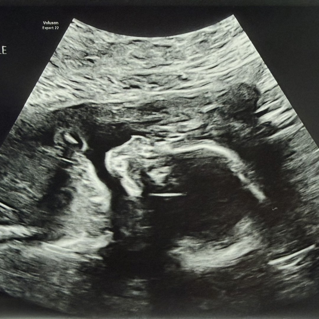 Photo shared by Breanna for their Babylist baby registry.