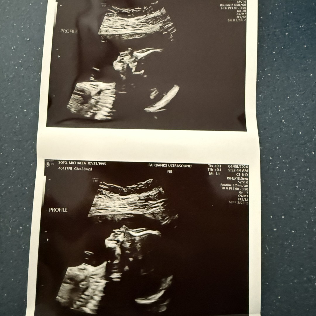 Photo shared by Michaela for their Babylist baby registry.