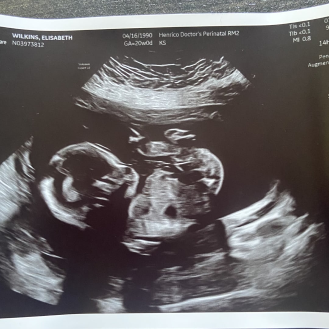Photo shared by Elisabeth for their Babylist baby registry.