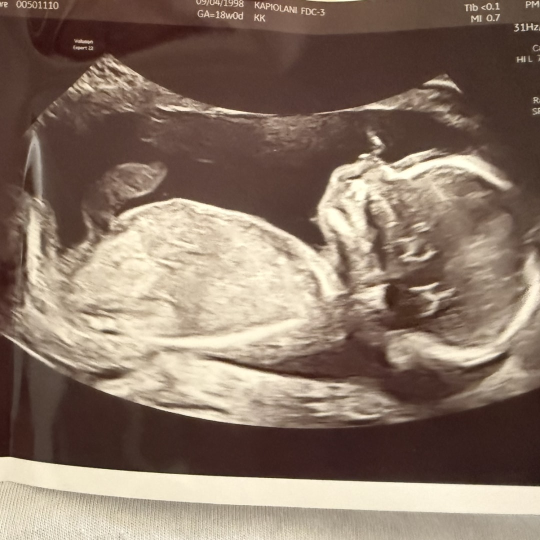 Photo shared by Jeralyn Kiku for their Babylist baby registry.