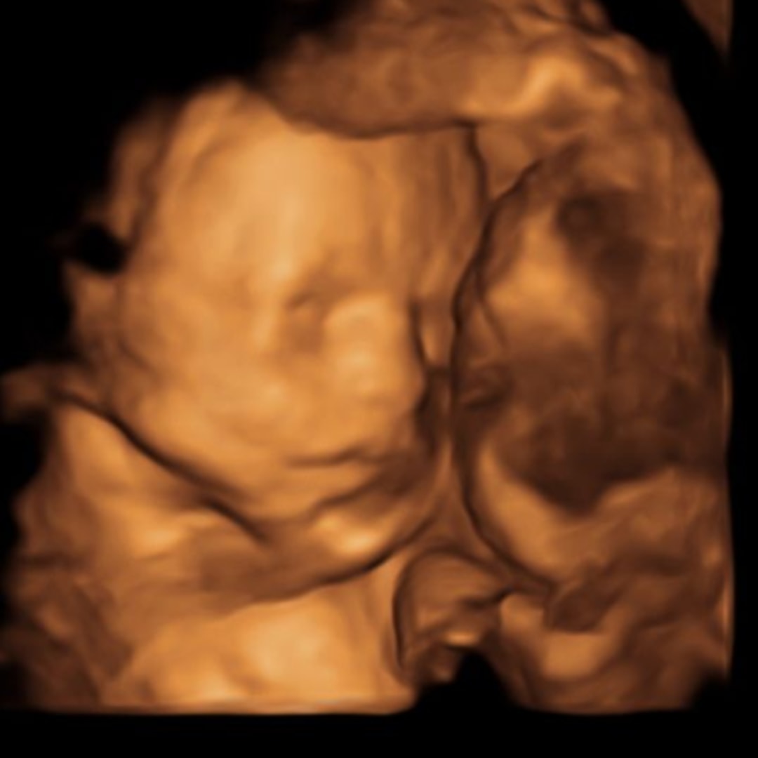 Photo shared by Kinley for their Babylist baby registry.