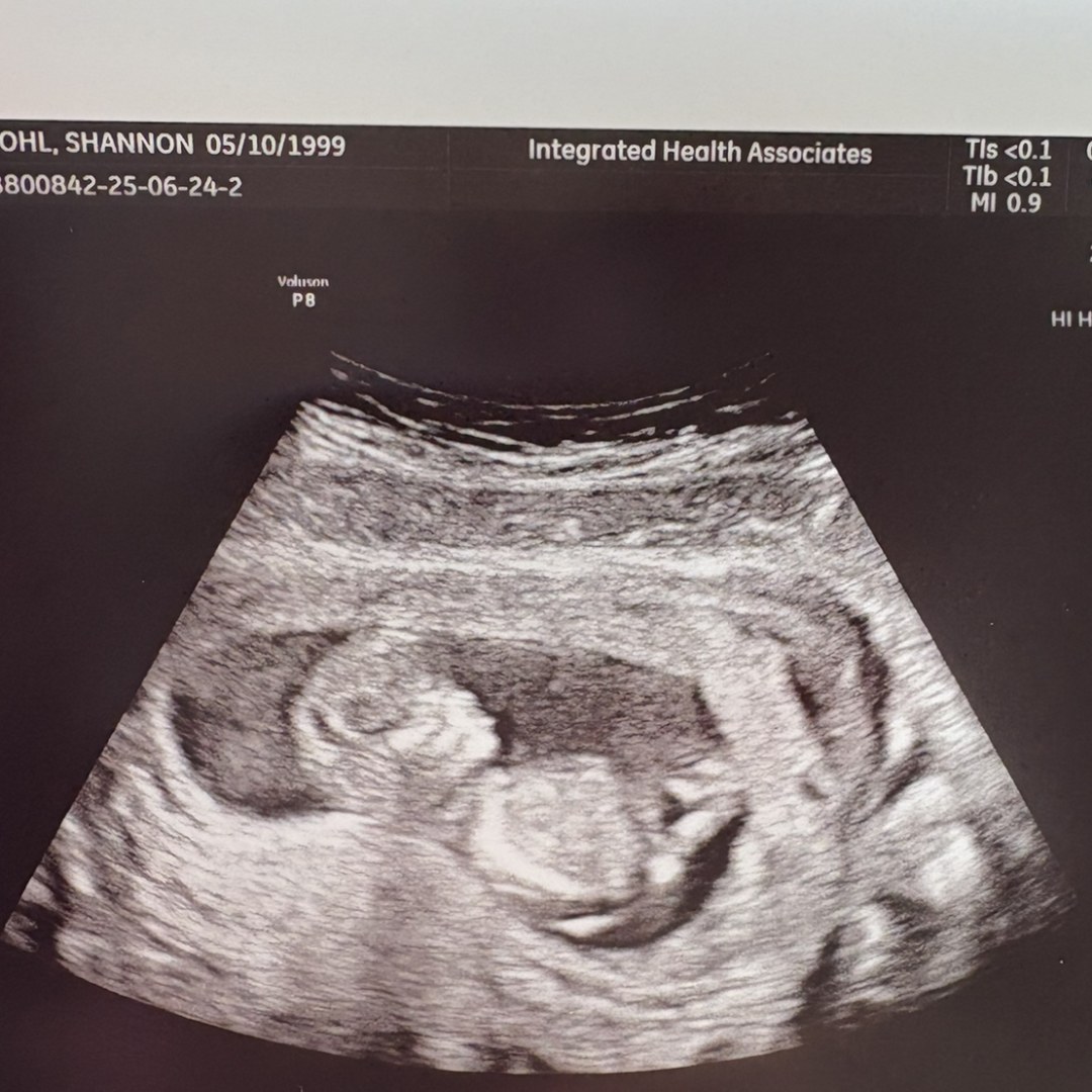 Photo shared by Shannon for their Babylist baby registry.