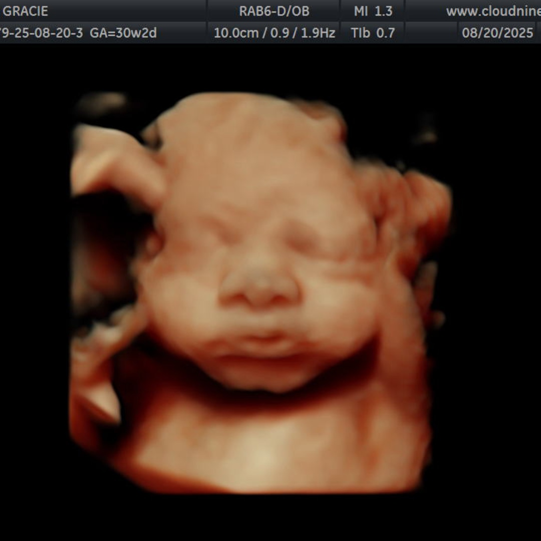 Photo shared by Gracie for their Babylist baby registry.