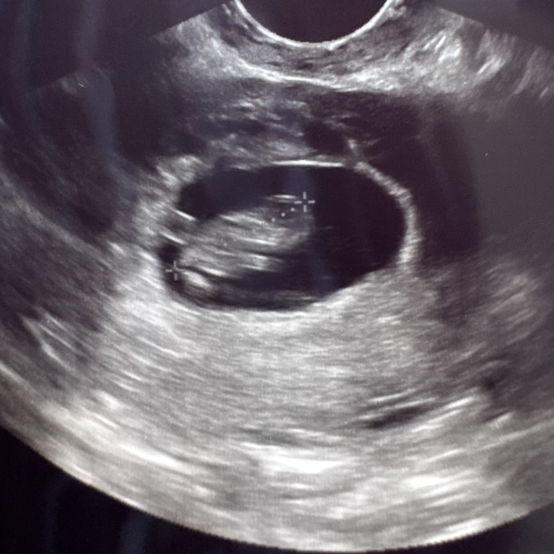 Photo shared by Sofia for their Babylist baby registry.