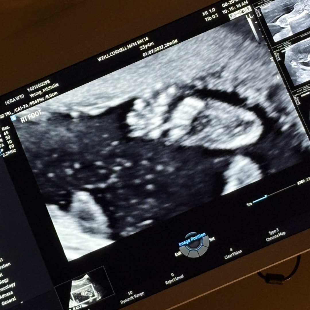 Photo shared by Michelle for their Babylist baby registry.