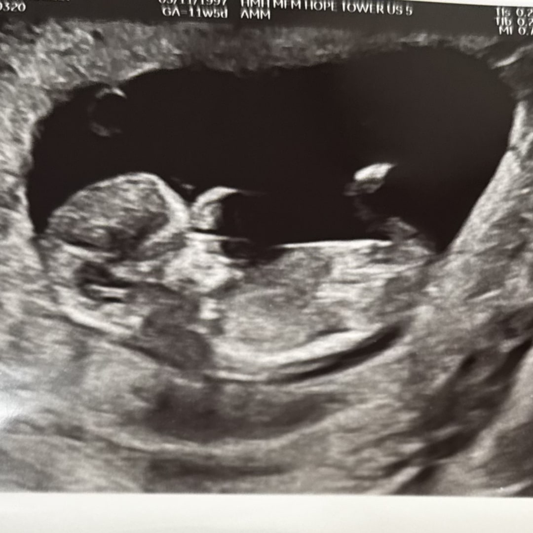 Photo shared by Adelly for their Babylist baby registry.