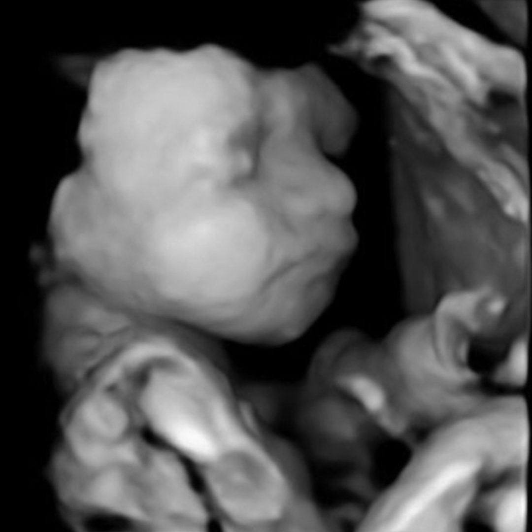 Photo shared by Shelby for their Babylist baby registry.