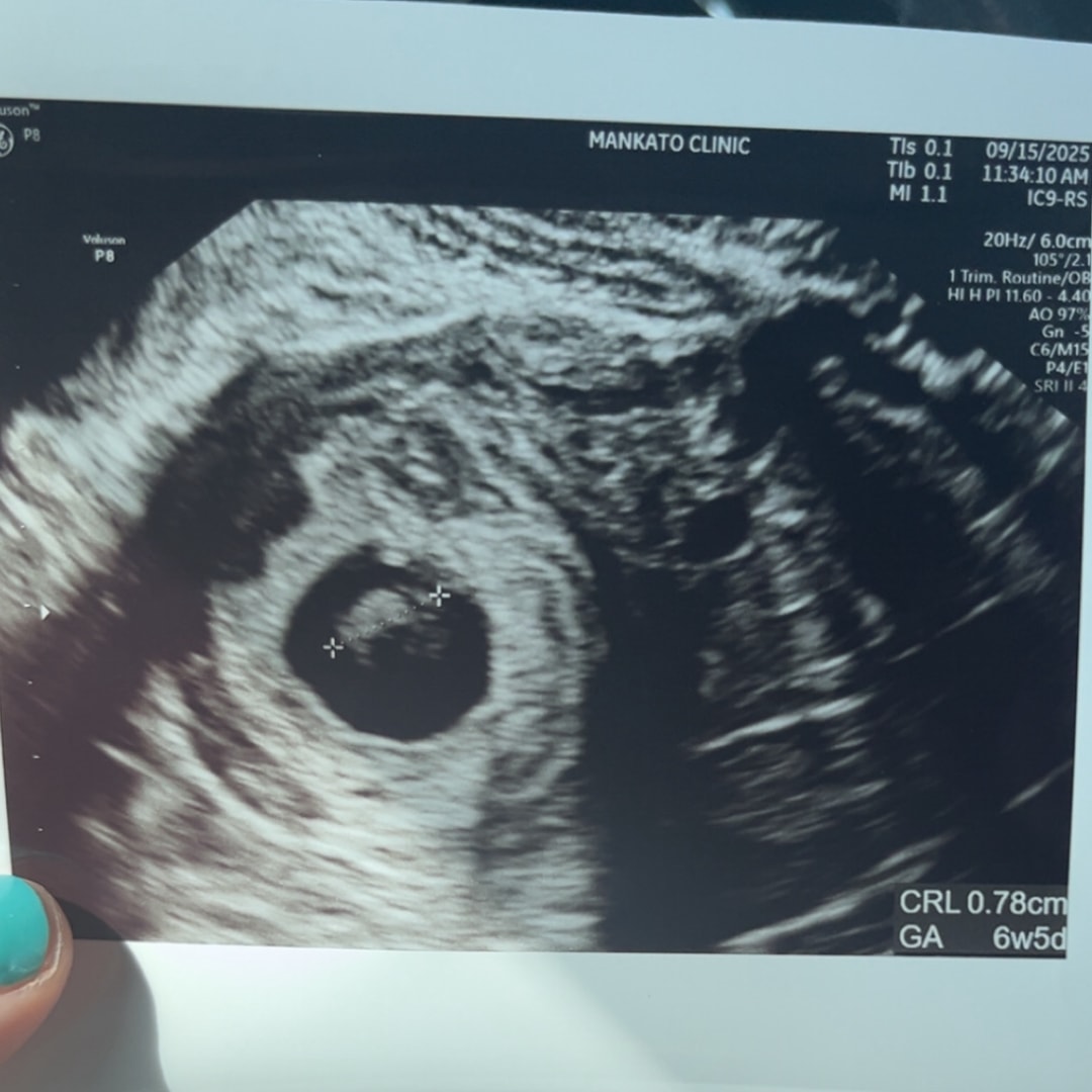 Photo shared by Ellie for their Babylist baby registry.