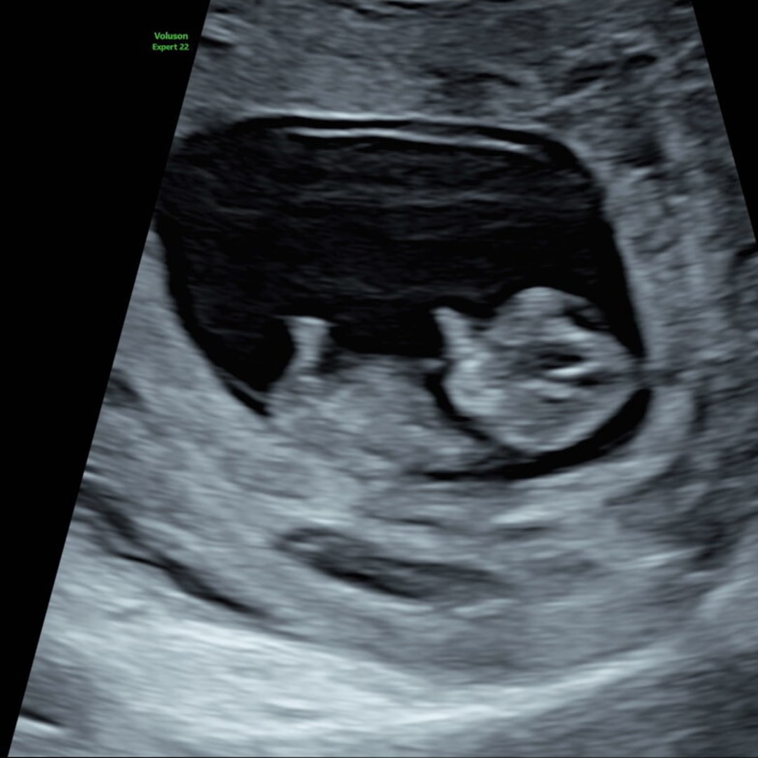 Photo shared by Elizabeth for their Babylist baby registry.